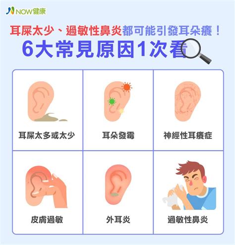 左耳養|耳朵癢是耳屎太多？6大原因、4招緩解 專家1次告訴。